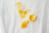 Como tirar nódoa de banana: receitas para tirar manchas de roupas e mais!
